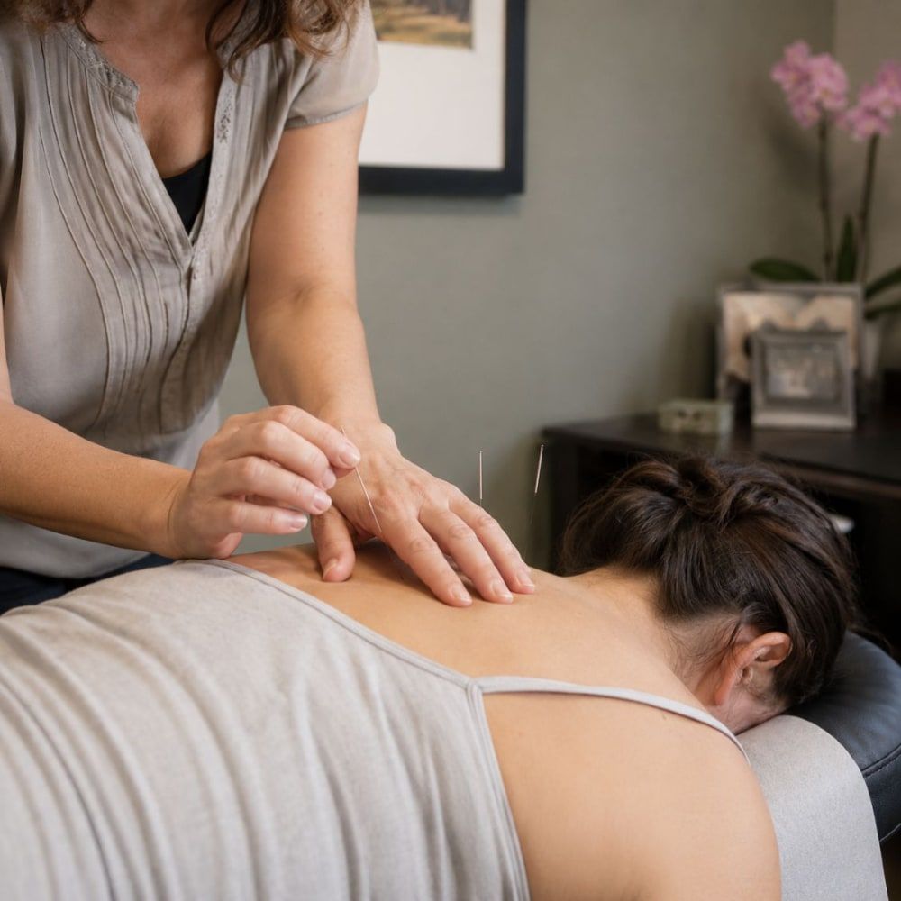 Acupuncture needles placed along the upper back